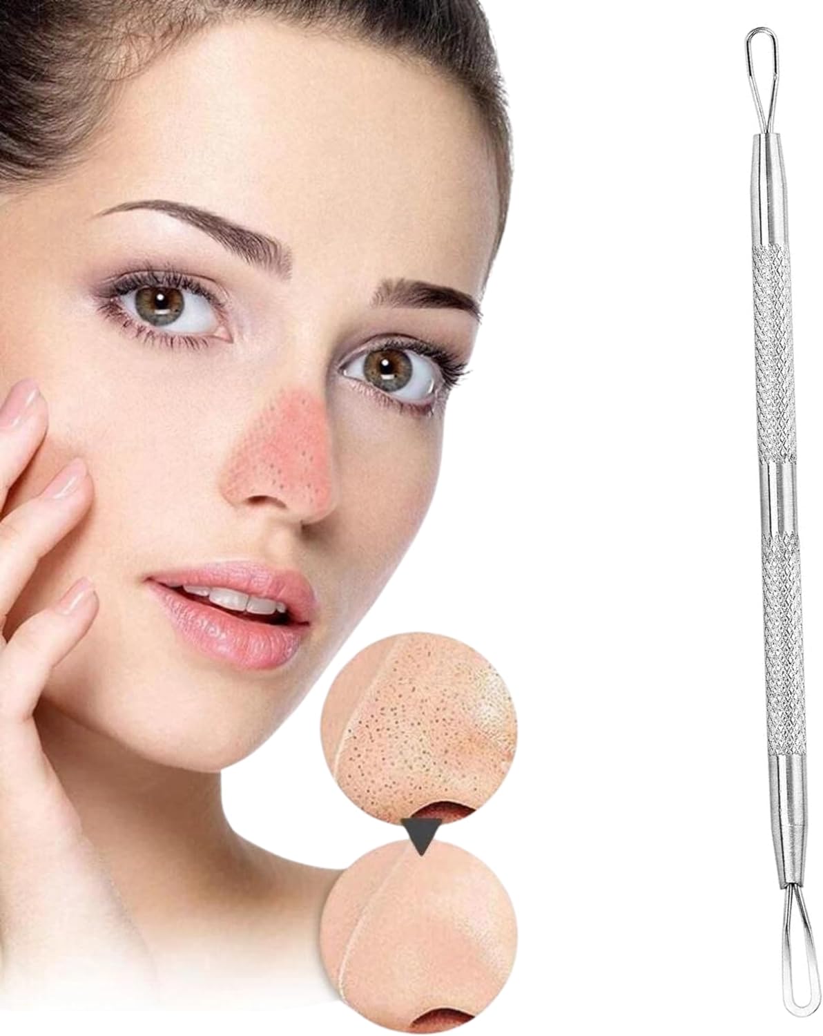 Wishbeauty Anti-Slip Blackhead & Whitehead Removal Skincare Tool – Your No-Slip Solution for Clear Skin